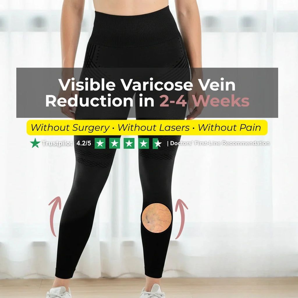 Visible Vein Relief in Just 14 Days with 3D Compression Leggings