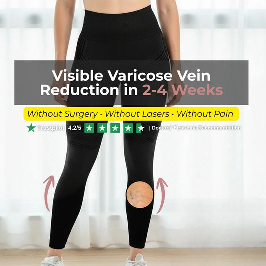 Visible Vein Relief in Just 14 Days with 3D Compression Leggings