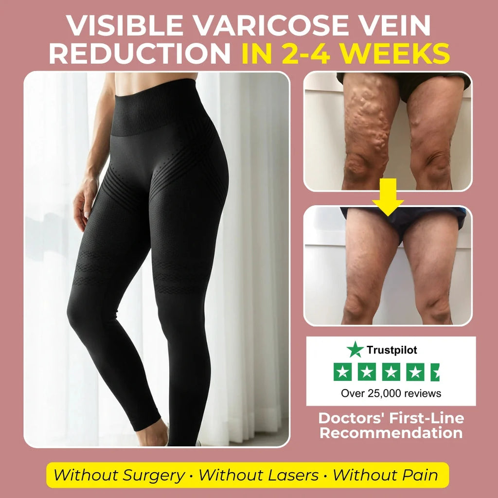 Visible Vein Relief in Just 14 Days with 3D Compression Leggings