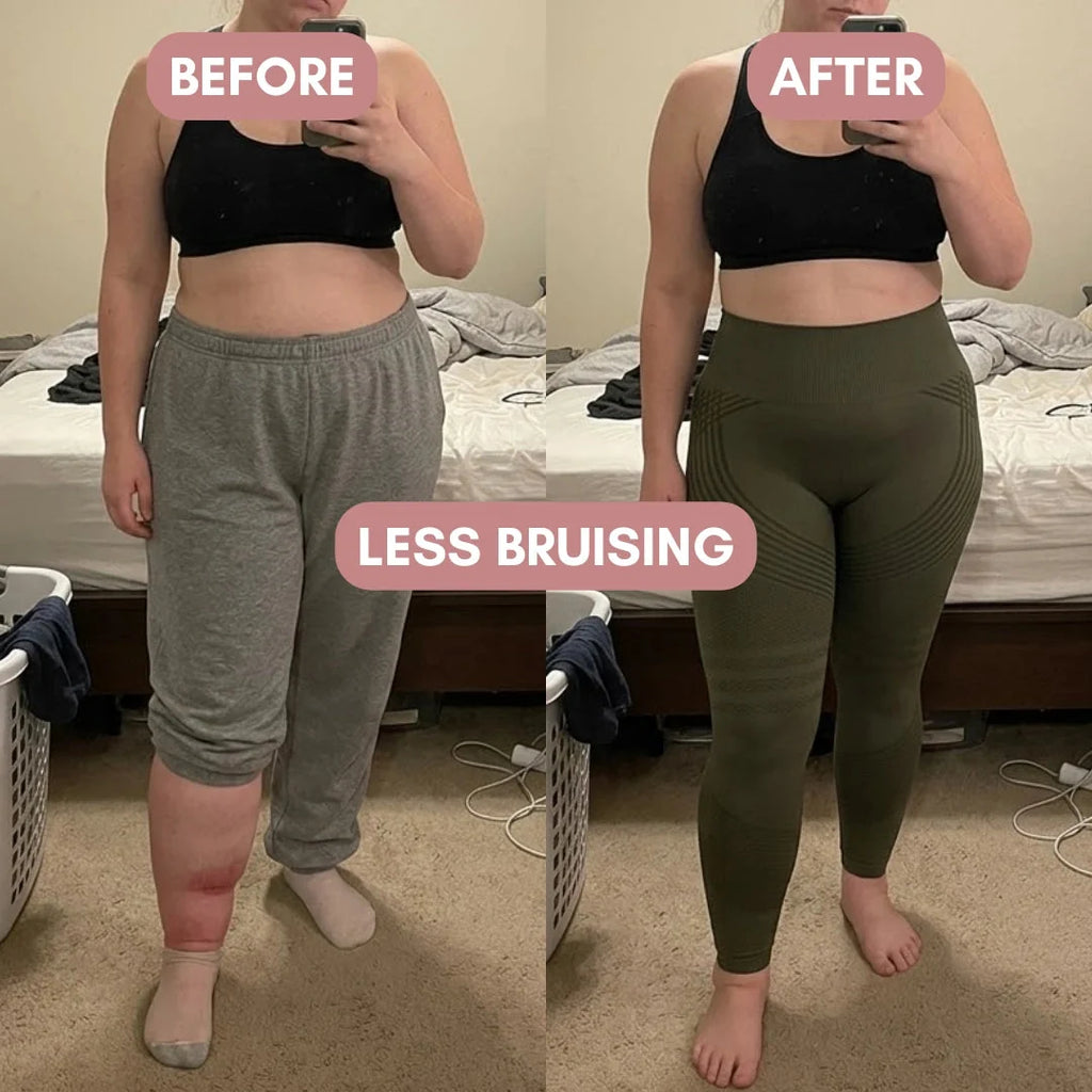 3D Legging – For Legs That Felt Like Anvils