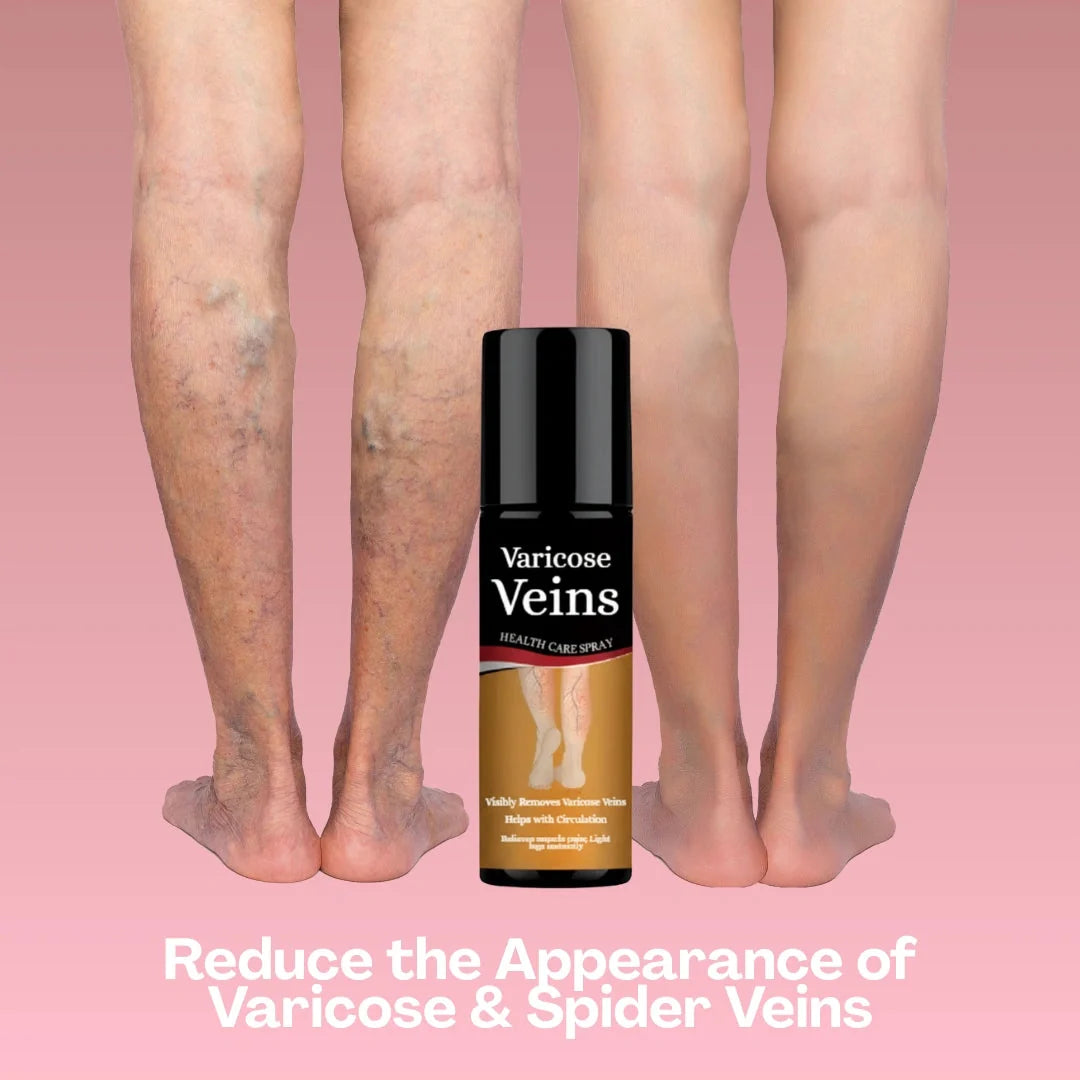 Varicose Vein Spray Leg Pain Gone, Confidence On