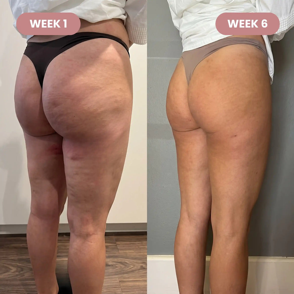 3D short - Redefine your silhouette effortlessly