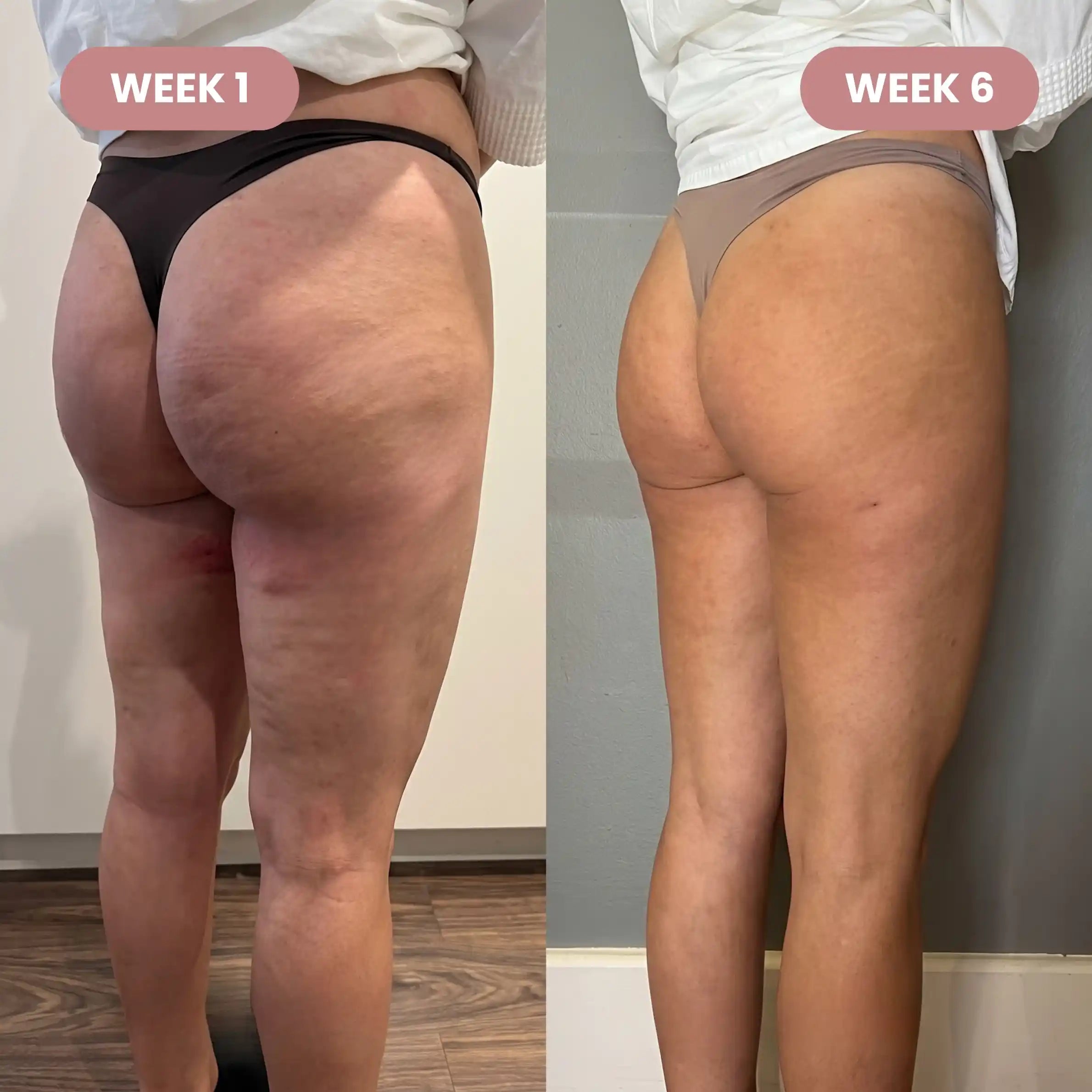 3D short - Redefine your silhouette effortlessly