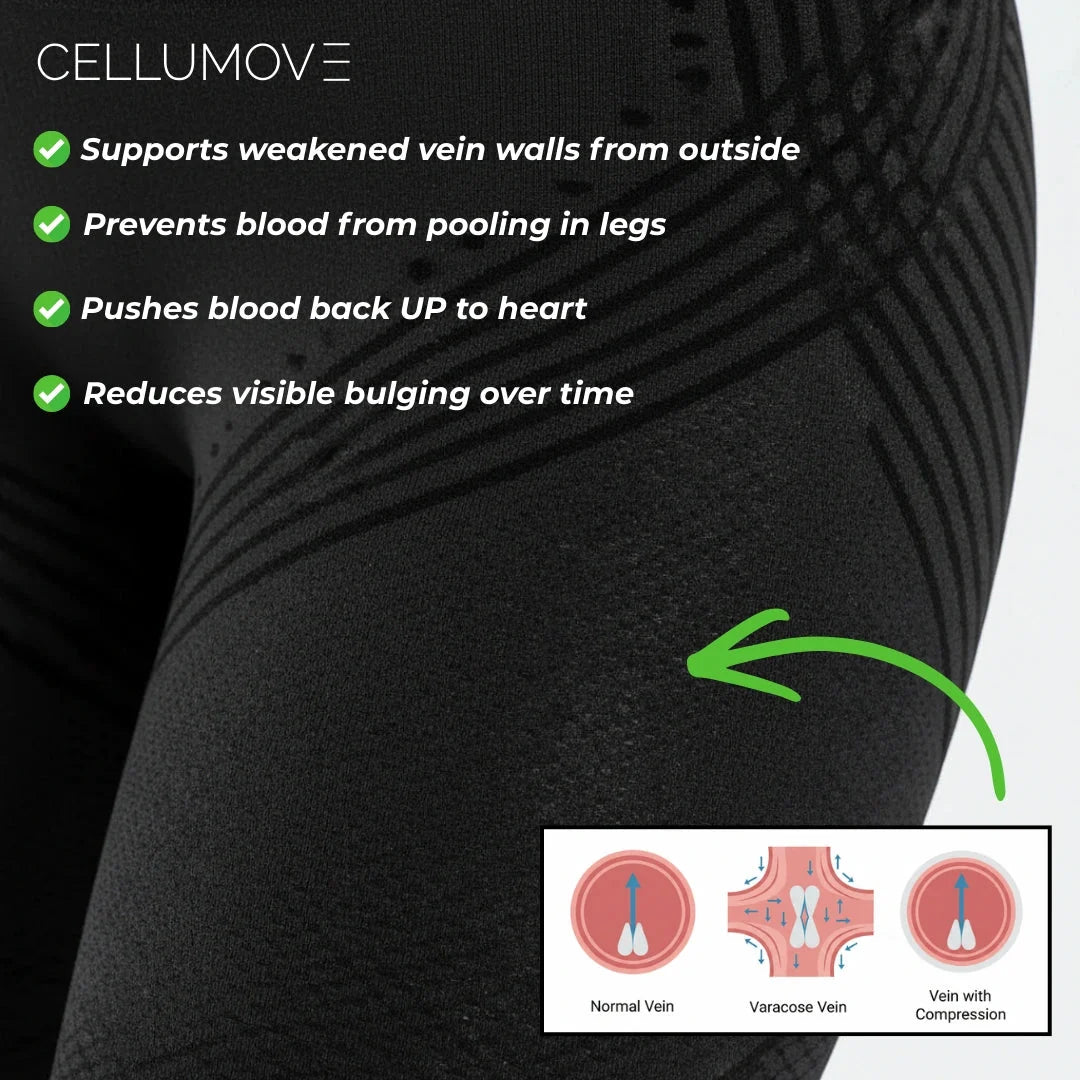 Visible Vein Relief in Just 14 Days with 3D Compression Leggings