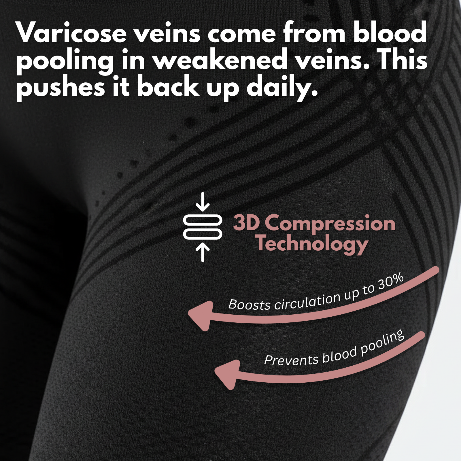 VARICOSE VEINS
