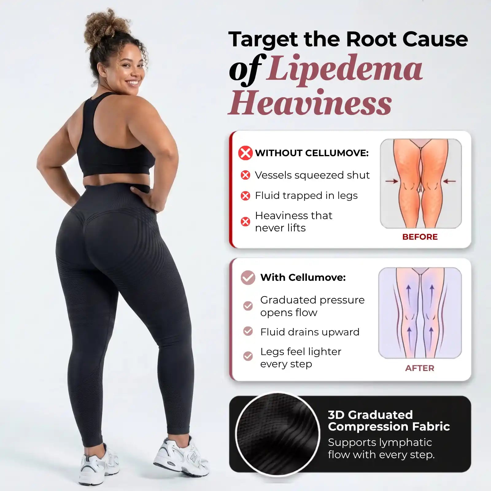3D Legging – Say goodbye to lipoedema pain and swelling naturally
