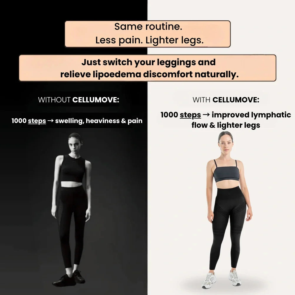 3D Legging – Say goodbye to lipoedema pain and swelling naturally.