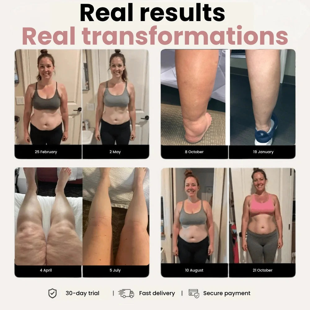 3D Legging – Designed to reduce post-partum swelling and restore comfort naturally.