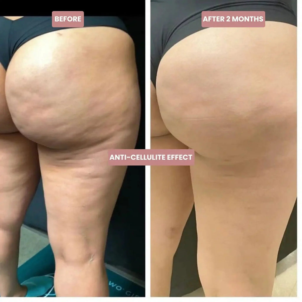 3D Legging – Redefine your silhouette effortlessly